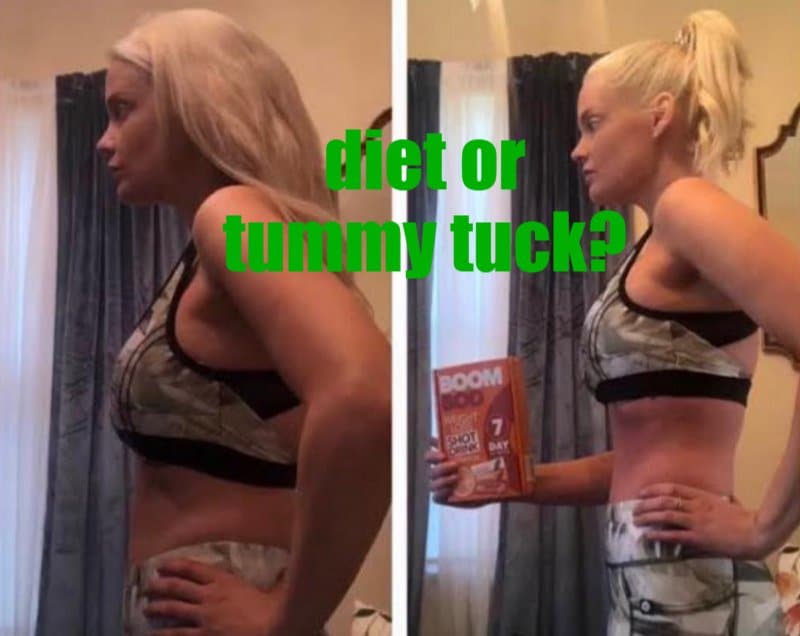 90 Day Fiance: Ashley Martson Tummy Tuck