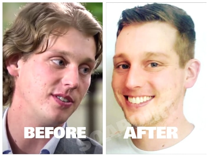 Married at First Sight: Austin Hurd - Before - After