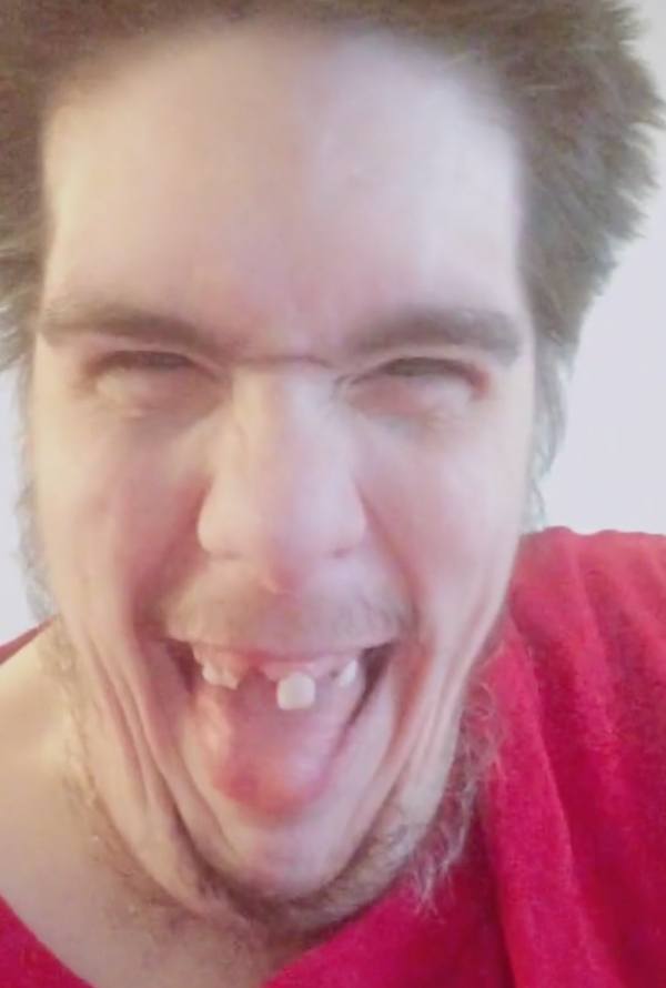 My 600-lb Life: Steven Assanti