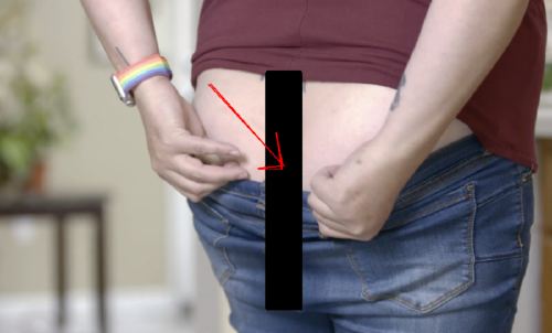 Dr. Pimple Popper: Veronica