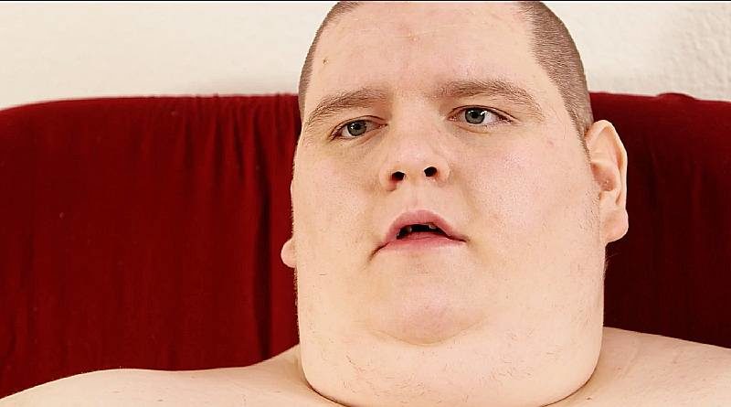 My 600-lb Life: Sean Milliken