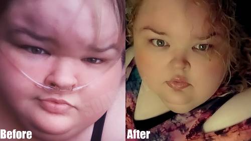 1000-lb Sisters: Tammy Slaton