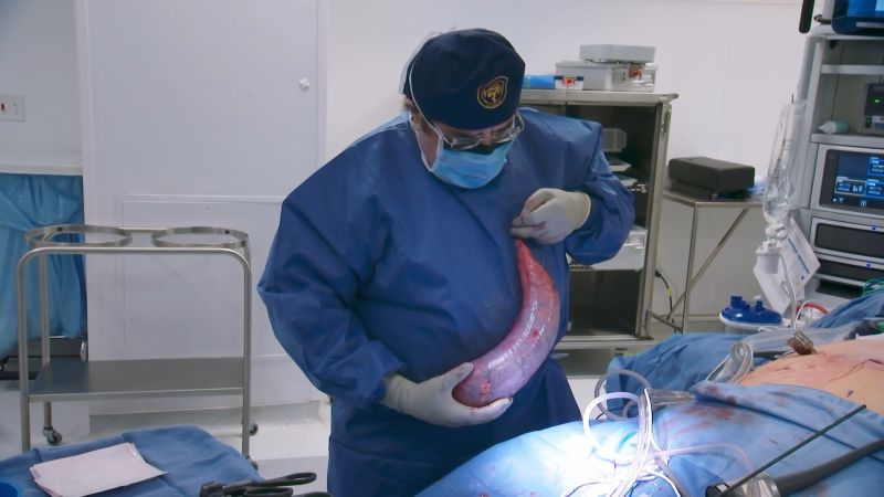My 600-lb Life: Dr. Younan Nowzaradan