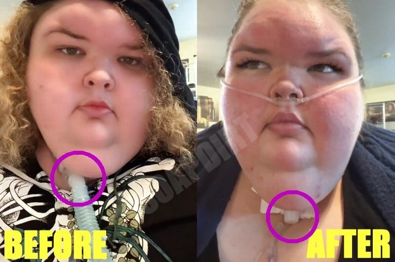 1000-Lb Sisters: Tammy Slaton