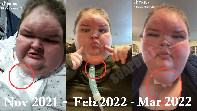 1000-Lb Sisters: Tammy Slaton