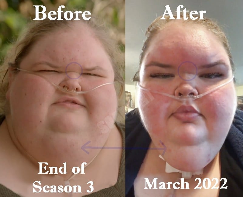 Tammy Slaton: before and after - 1000-Lb Sisters