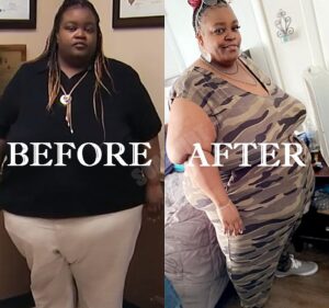 'my 600-lb Life': Tammy Patton's Shocking Weight Loss - See Before 