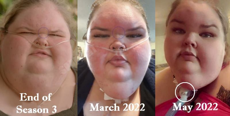 1000-Lb Sisters: Tammy Slaton
