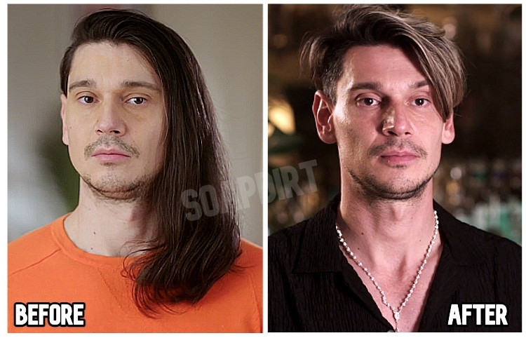 georgi rusev plastic surgery Image 9